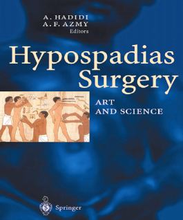 Hypospadias Surgery - An Illustrated Guide